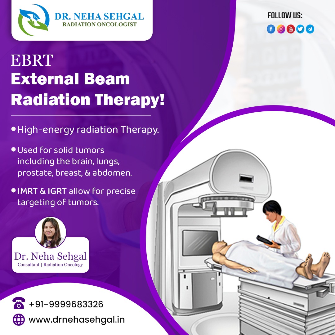 External Beam Radiation Therapy